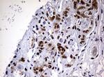 NBN Antibody in Immunohistochemistry (Paraffin) (IHC (P))