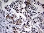 NBN Antibody in Immunohistochemistry (Paraffin) (IHC (P))