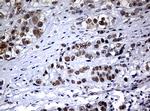 NBN Antibody in Immunohistochemistry (Paraffin) (IHC (P))