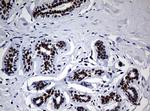 NBN Antibody in Immunohistochemistry (Paraffin) (IHC (P))