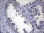 NBN Antibody in Immunohistochemistry (Paraffin) (IHC (P))