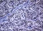 NBN Antibody in Immunohistochemistry (Paraffin) (IHC (P))