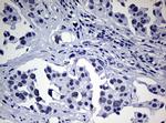 NBN Antibody in Immunohistochemistry (Paraffin) (IHC (P))