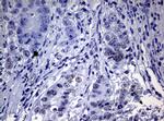 NBN Antibody in Immunohistochemistry (Paraffin) (IHC (P))
