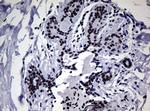 NBN Antibody in Immunohistochemistry (Paraffin) (IHC (P))