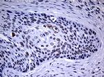 NBN Antibody in Immunohistochemistry (Paraffin) (IHC (P))