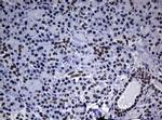 NBN Antibody in Immunohistochemistry (Paraffin) (IHC (P))