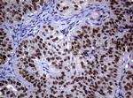 NBN Antibody in Immunohistochemistry (Paraffin) (IHC (P))