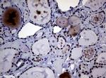 NBN Antibody in Immunohistochemistry (Paraffin) (IHC (P))