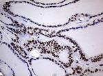 NBN Antibody in Immunohistochemistry (Paraffin) (IHC (P))