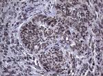NBN Antibody in Immunohistochemistry (Paraffin) (IHC (P))