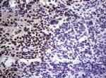 NBN Antibody in Immunohistochemistry (Paraffin) (IHC (P))