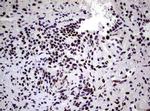 NBN Antibody in Immunohistochemistry (Paraffin) (IHC (P))