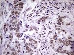 NBN Antibody in Immunohistochemistry (Paraffin) (IHC (P))