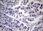 NBN Antibody in Immunohistochemistry (Paraffin) (IHC (P))