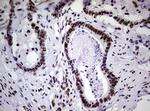 NBN Antibody in Immunohistochemistry (Paraffin) (IHC (P))