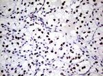 NBN Antibody in Immunohistochemistry (Paraffin) (IHC (P))