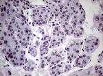 NBN Antibody in Immunohistochemistry (Paraffin) (IHC (P))