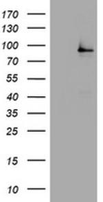 NBN Antibody in Western Blot (WB)