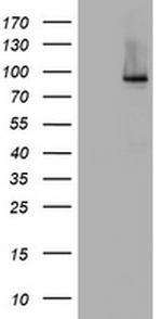 NBN Antibody in Western Blot (WB)
