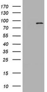 NBN Antibody in Western Blot (WB)