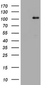 NBN Antibody in Western Blot (WB)