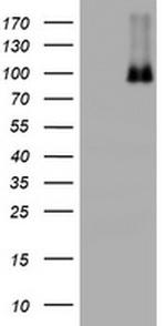 NBN Antibody in Western Blot (WB)