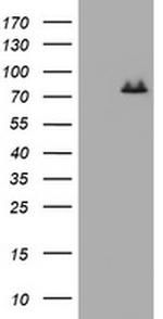NBN Antibody in Western Blot (WB)