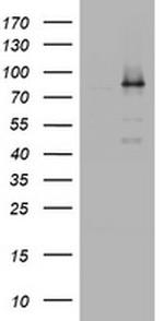 NBN Antibody in Western Blot (WB)