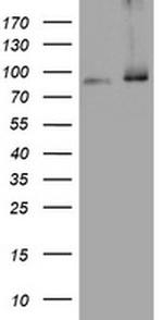 NBN Antibody in Western Blot (WB)