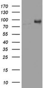 NBN Antibody in Western Blot (WB)