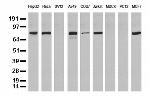 NBN Antibody in Western Blot (WB)