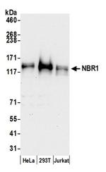 NBR1 Antibody in Western Blot (WB)