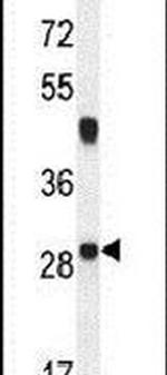 NCALD Antibody in Western Blot (WB)