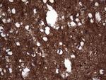 NCAM1 Antibody in Immunohistochemistry (Paraffin) (IHC (P))