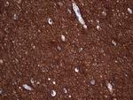 NCAM1 Antibody in Immunohistochemistry (Paraffin) (IHC (P))