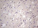 NCAM1 Antibody in Immunohistochemistry (Paraffin) (IHC (P))