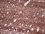 NCAM1 Antibody in Immunohistochemistry (Paraffin) (IHC (P))
