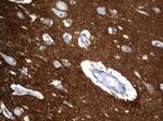 NCAM1 Antibody in Immunohistochemistry (Paraffin) (IHC (P))