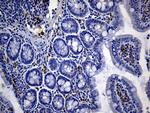 NCAM1 Antibody in Immunohistochemistry (Paraffin) (IHC (P))