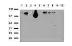 NCAM1 Antibody in Western Blot (WB)