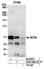 NCDN Polyclonal Antibody