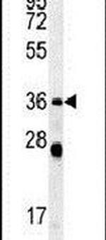 p47phox Antibody in Western Blot (WB)
