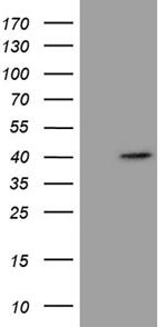 NCF4 Antibody in Western Blot (WB)
