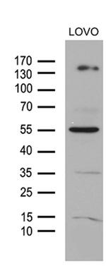 NCOA7 Antibody in Western Blot (WB)