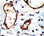 NCoR1 Antibody in Immunohistochemistry (IHC)