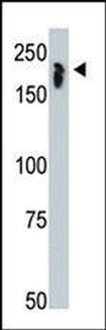NCoR1 Antibody in Western Blot (WB)