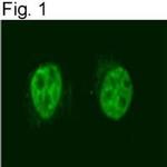 NCoR2 Antibody in Immunocytochemistry (ICC/IF)