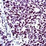 NCoR2 Antibody in Immunohistochemistry (IHC)