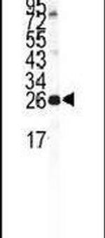 NCS1 Antibody in Western Blot (WB)
